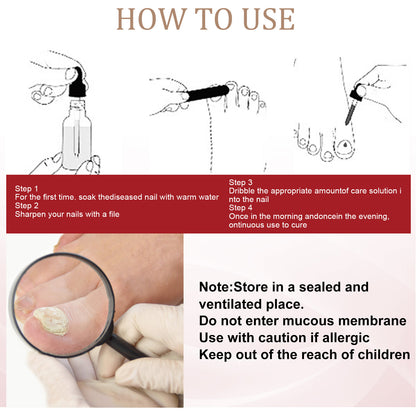 EELHOE Nail Repair Solution, Hands And Feet Nail Repair Moisturizing Clean And Remove Gray Nail Repair Solution